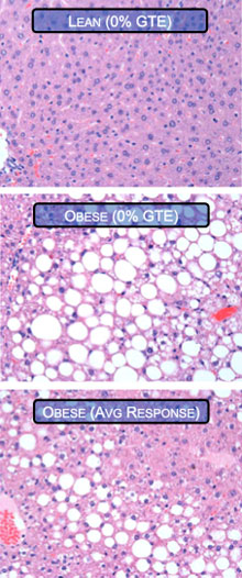 TOP: Amicroscopic image of a liver from a lean mouse fed no green tea extract, illustrating a normal, healthy liver with no evidence of hepatic steatosis (fat accumulation in the liver). MIDDLE: image from an obese mouse fed no green tea extract, illustrating the severity of hepatic steatosis that naturally occurs in obese mice due to a genetic defect. BOTTOM: image from an obese mouse fed green tea extract, illustrating the typical improvement in the degree of fat accumulation in the liver.